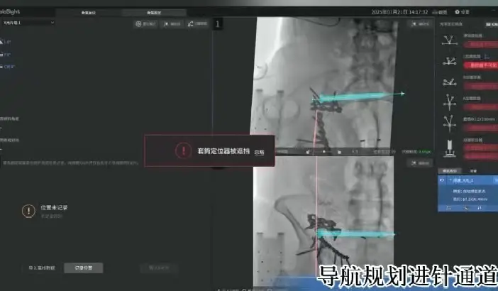 大连理工大学附属中心医院新神器就位！ 可视化智能导航定位系统，开启骨折智化精准治疗新时代